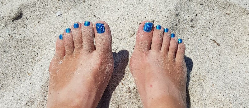 Medisch pedicure behandeling in Follega